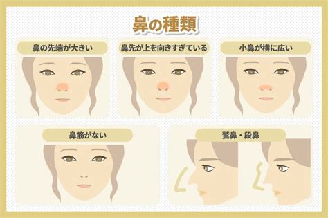 鼻頭中間凹|鼻の名称・形・種類とその治療法について（だんご鼻。